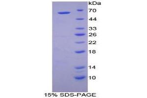SDS-PAGE analysis of Dog Cathepsin A Protein. (CTSA 蛋白)