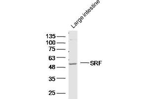 Western Blotting (WB) image for anti-Serum Response Factor (SRF) (AA 101-250) antibody (ABIN686017)