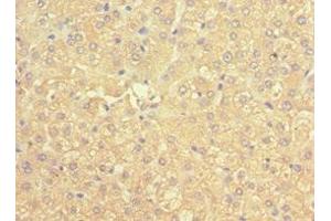 Immunohistochemistry of paraffin-embedded human liver tissue using ABIN7169536 at dilution of 1:100 (ACADS 抗体  (AA 1-260))