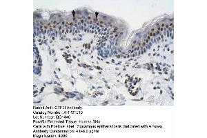 Rabbit Anti-GTF21 Antibody  Paraffin Embedded Tissue: Human Skin Cellular Data: Squamous epithelial cells Antibody Concentration: 4. (GTF2I 抗体  (N-Term))