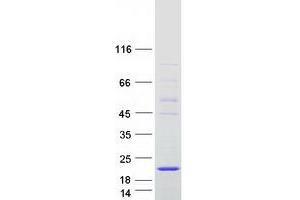 Western Blotting (WB) image for AlkB, Alkylation Repair Homolog 6 (ALKBH6) (Transcript Variant 1) protein (Myc-DYKDDDDK Tag) (ABIN2715940)