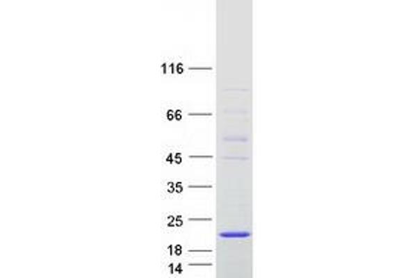 ALKBH6 Protein (Transcript Variant 1) (Myc-DYKDDDDK Tag)