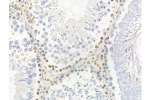 Phospho-AurB/C (Thr236/Thr202) Antibody at 1/100 staining Rat testis tissue by IHC-P. (AurB/C 抗体  (pThr202, pThr236))