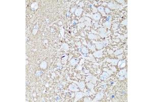 Immunohistochemistry of paraffin-embedded rat brain using V antibody (ABIN3021846, ABIN3021847, ABIN1513674 and ABIN6216136) at dilution of 1:100 (40x lens). (VAMP2 抗体  (AA 1-100))