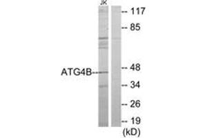 Western blot analysis of extracts from Jurkat cells, using ATG4B Antibody. (ATG4B 抗体  (AA 71-120))