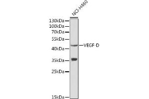 Western blot analysis of extracts of NCI-H460 cells, using VEGFD antibody (ABIN3021685, ABIN3021686, ABIN3021687 and ABIN6215506) at 1:1000 dilution. (VEGFD 抗体  (AA 20-220))