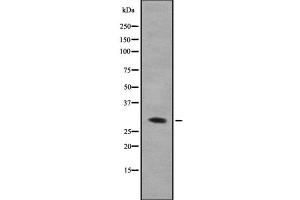 Western blot analysis of hnRNP A0 using COLO205 whole cell lysates (HNRNPA0 抗体  (Internal Region))