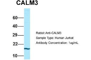 Host: Rabbit  Target Name: CALM3  Sample Tissue: Human Jurkat  Antibody Dilution: 1. (Calmodulin 3 抗体  (N-Term))