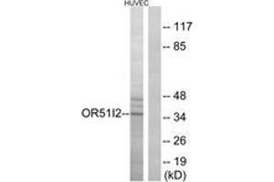 Western blot analysis of extracts from HuvEc cells, using OR51I2 Antibody. (OR51I2 抗体  (AA 201-250))