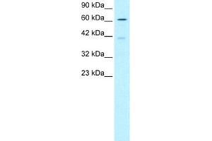 WB Suggested Anti-SKIIP Antibody Titration:  0. (SNW1 抗体  (N-Term))