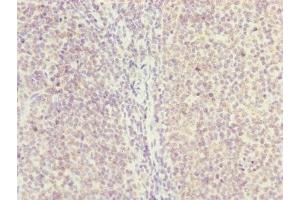 Immunohistochemistry of paraffin-embedded human tonsil tissue using ABIN7154838 at dilution of 1:100 (NYS48/HAUS8 抗体  (AA 166-410))