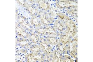 Immunohistochemistry of paraffin-embedded rat kidney using LRP2 antibody (ABIN5995557) at dilution of 1/100 (40x lens). (LRP2 抗体)