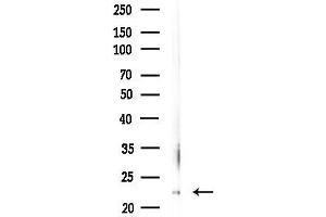 Western blot analysis of lysates from Mouse testis, using SNAP23 Antibody at 1/1000 dilution.