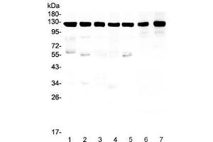 Western blot testing of Amyloid beta antibody and Lane 1:  rat brain