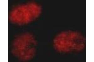 Immunofluorescence (IF) image for anti-SWI/SNF Related, Matrix Associated, Actin Dependent Regulator of Chromatin, Subfamily A, Member 4 (SMARCA4) (C-Term) antibody (ABIN2451926)