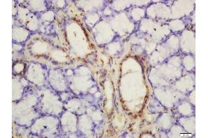 Immunohistochemistry (Paraffin-embedded Sections) (IHC (p)) image for anti-Pyruvate Kinase M2 (PKM2) (pTyr105) antibody (ABIN744773)