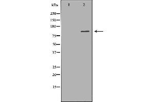 Western blot analysis of Jurkat whole cell lysates, using HADHA Antibody. (HADHA 抗体  (C-Term))