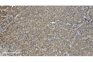 IHC analysis of U2AF65/U2AF2 using anti U2AF65/U2AF2 antibody (ABIN7600794). (U2AF2 抗体  (AA 238-470))