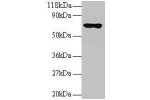 Western blot All lanes: RPL15 antibody at 2 μg/mL + 293T whole cell lysate Secondary Goat polyclonal to rabbit IgG at 1/15000 dilution Predicted band size: 25, 17 kDa Observed band size: 70 kDa (RPL15 抗体  (AA 2-204))