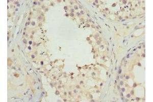 Immunohistochemistry of paraffin-embedded human testis tissue using ABIN7174649 at dilution of 1:100