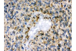 Anti- Eph receptor B1 Picoband antibody, IHC(P) IHC(P): Human Glioma Tissue (EPH Receptor B1 抗体  (N-Term))
