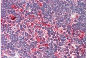 Human Thymus (formalin-fixed, paraffin-embedded) stained with IL32 antibody ABIN214502 at 2. (IL32 抗体  (C-Term))