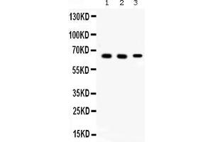 Western blot analysis of Alpha Internexin expression in rat brain extract ( Lane 1), mouse brain extract ( Lane 2) and 22RV1 whole cell lysates ( Lane 3). (INA 抗体  (AA 71-161))