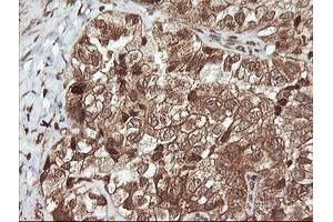 Image no. 2 for anti-Ubiquitin-Conjugating Enzyme E2G 2 (UBE2G2) antibody (ABIN1501634) (UBE2G2 抗体)