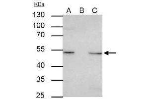 IP Image ILK antibody [N1C1] immunoprecipitates ILK protein in IP experiments. (ILK 抗体)