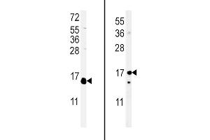 (LEFT)Western blot analysis of IL4 Antibody (C-term) (ABIN651434 and ABIN2840238) in WiDr cell line lysates (35 μg/lane). (IL-4 抗体  (C-Term))