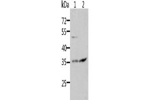 Western Blotting (WB) image for anti-Suppressor of Cytokine Signaling 1 (SOCS1) antibody (ABIN2431838) (SOCS1 抗体)