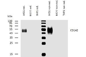 Western blotting analysis of human CD142 using mouse monoclonal antibody HTF-1 on lysates of A431 cell line and MCF7 and THP1 cell lines (negative controls) under reducing and non-reducing conditions. (Tissue factor 抗体)