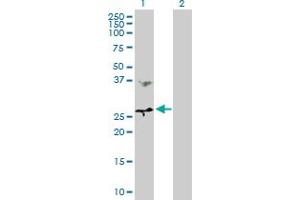 Western Blot analysis of MTHFD2 expression in transfected 293T cell line by MTHFD2 MaxPab polyclonal antibody. (MTHFD2 抗体  (AA 1-248))