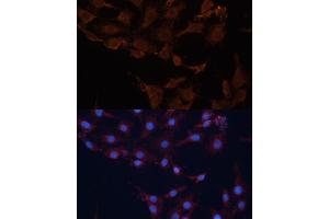 Immunofluorescence analysis of C6 cells using HMGCS1 Polyclonal Antibody (ABIN1680300, ABIN5664518, ABIN5664520 and ABIN6220423) at dilution of 1:100 (40x lens).
