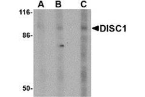 Western blot analysis of DISC1 in SK-N-SH cell lysate with AP30292PU-N DISC1 antibody at (A) 0. (DISC1 抗体  (Center))