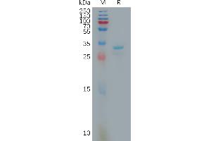 Human Protein, His Tag on SDS-PAGE under reducing condition.