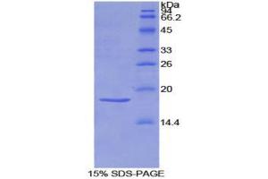 SDS-PAGE (SDS) image for Sema Domain, Immunoglobulin Domain (Ig), Short Basic Domain, Secreted, (Semaphorin) 3A (SEMA3A) (AA 31-150) protein (His tag) (ABIN1877373) (SEMA3A Protein (AA 31-150) (His tag))