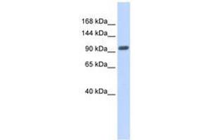 Image no. 1 for anti-Zinc Finger Protein 512B (ZNF512B) (AA 539-588) antibody (ABIN6740330) (ZNF512B 抗体  (AA 539-588))