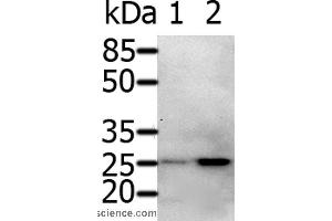 Western blot analysis of 231 cell and Human fetal brain tissue, using RAB5A Polyclonal Antibody at dilution of 1:600 (RAB5 抗体)