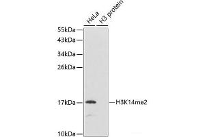 Western blot analysis of extracts of various cell lines using DiMethyl-Histone H3-K14 Polyclonal Antibody. (Histone 3 抗体  (2meLys14))