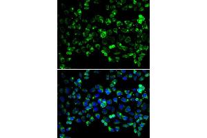 Immunofluorescence analysis of HeLa cells using PINK1 antibody (ABIN5998524). (PINK1 抗体)