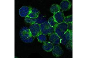Immunofluorescence analysis of Jurkat cells using ITK mouse mAb (green). (ITK 抗体)
