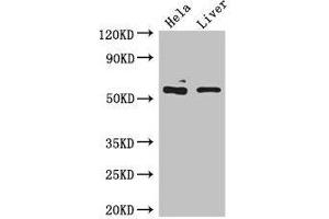 Western Blot Positive WB detected in: Hela whole cell lysate, Mouse liver tissue All lanes: KRT81 antibody at 5 μg/mL Secondary Goat polyclonal to rabbit IgG at 1/50000 dilution Predicted band size: 55 kDa Observed band size: 55 kDa (KRT81 抗体  (AA 3-505))