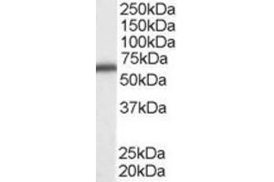 Western Blotting (WB) image for anti-DEAD (Asp-Glu-Ala-Asp) Box Polypeptide 5 (DDX5) (C-Term) antibody (ABIN2465593) (DDX5 抗体  (C-Term))
