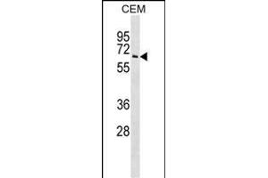 T Antibody (N-term) (ABIN1539423 and ABIN2848697) western blot analysis in CEM cell line lysates (35 μg/lane).