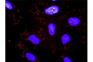 Proximity Ligation Analysis of protein-protein interactions between CACYBP and TBL1X. (CACYBP 抗体  (AA 1-228))