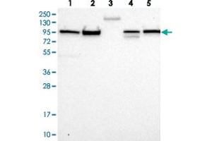 Western blot analysis of Lane 1: RT-4, Lane 2: U-251 MG, Lane 3: Human Plasma, Lane 4: Liver, Lane 5: Tonsil with FCHSD2 polyclonal antibody  at 1:250-1:500 dilution. (FCHSD2 抗体)