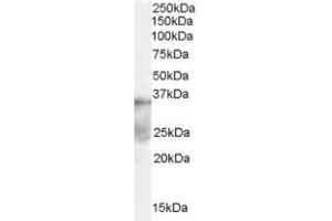 Image no. 1 for anti-Deleted in Azoospermia-Like (DAZL) (Internal Region) antibody (ABIN374590) (DAZL 抗体  (Internal Region))