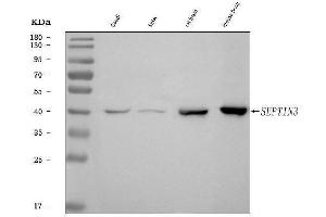 Western blot analysis of Septin 3/SEPTIN3 using anti-Septin 3/SEPTIN3 antibody (ABIN7599288).