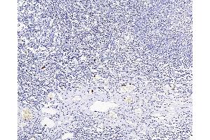 Immunohistochemistry (Paraffin-embedded Sections) (IHC (p)) image for anti-Integrin, alpha X (Complement Component 3 Receptor 4 Subunit) (ITGAX) antibody (ABIN7249394)